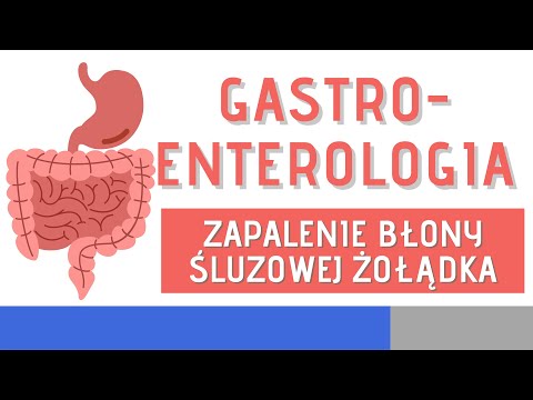 Zapalenie błony śluzowej żołądka