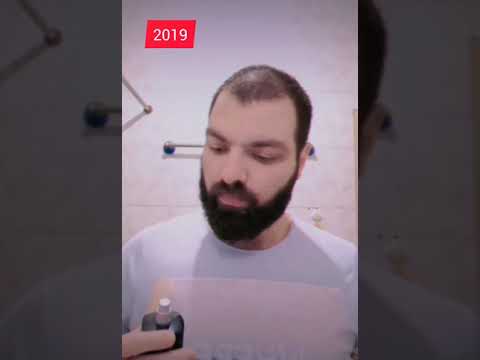 Corona virus 2020 VS 2019