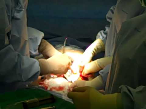Isang iniksyon ng testosterone para sa pagbaba ng timbang Nabawasan ako ng timbang at hindi makakuha ng mas mahusay