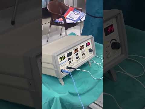 Radiofrequency treatment for spine pain explained by JPRC Neuro Spine Centre