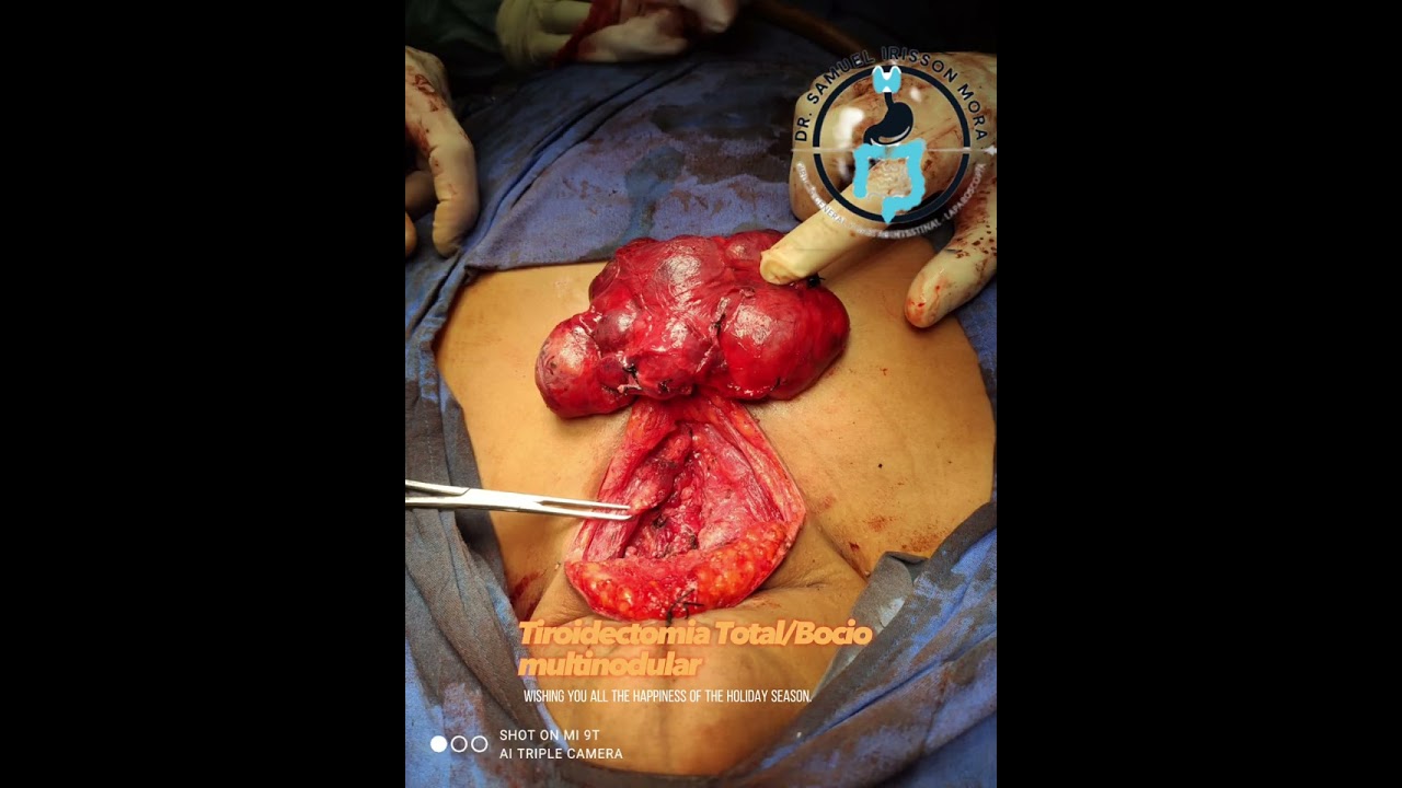 Samuel Irisson Mora-15