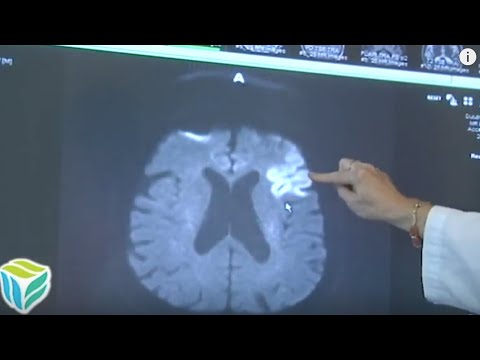 Medical Insight: Stroke Certification - Essentia Health