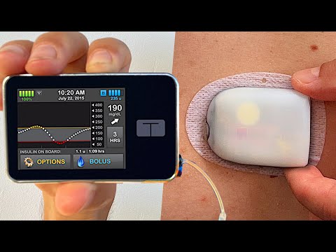 Omnipod 5 vs Tandem t:slim x2 | Full Test & Review