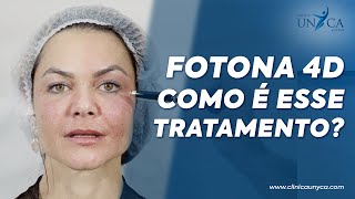 Clínica Unyca | Fotona 4D, Como É Esse Tratamento?