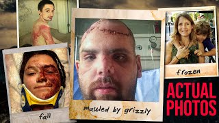 A GRIZZLY MAULED HIM 3 TIMES (& 3 more incredible survival stories)