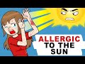 I Am Allergic To The Sun