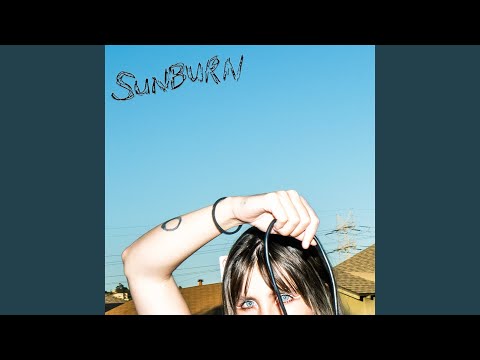 Sunburn