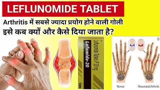 Leflunomide Tablets Uses Dose & Side Effects | Medicine for rheumatoid arthritis
