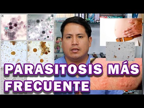 CÓMO ELIMINAR EL BLASTOCYSTIS HOMINIS | UN PARÁSITO MUY FRECUENTE