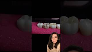 What Happens When you Need A Root Canal Treatment!