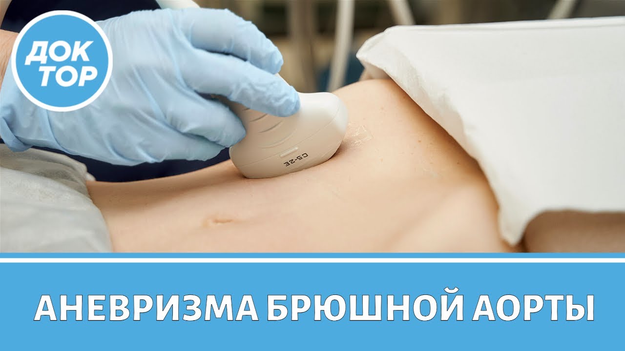 Как понять, что у вас аневризма брюшной аорты / Кто в группе риска