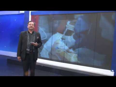 #Ahora - Cabeza de hombre fue hallada en el interior de una funda en Machala