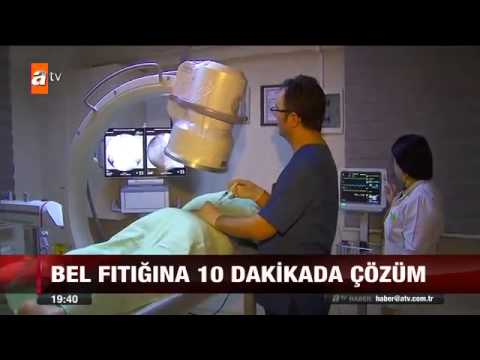 BEL FITIĞI NOKTA ATIŞI TEDAVİSİ - BAKIRKÖY AĞRI MERKEZİ