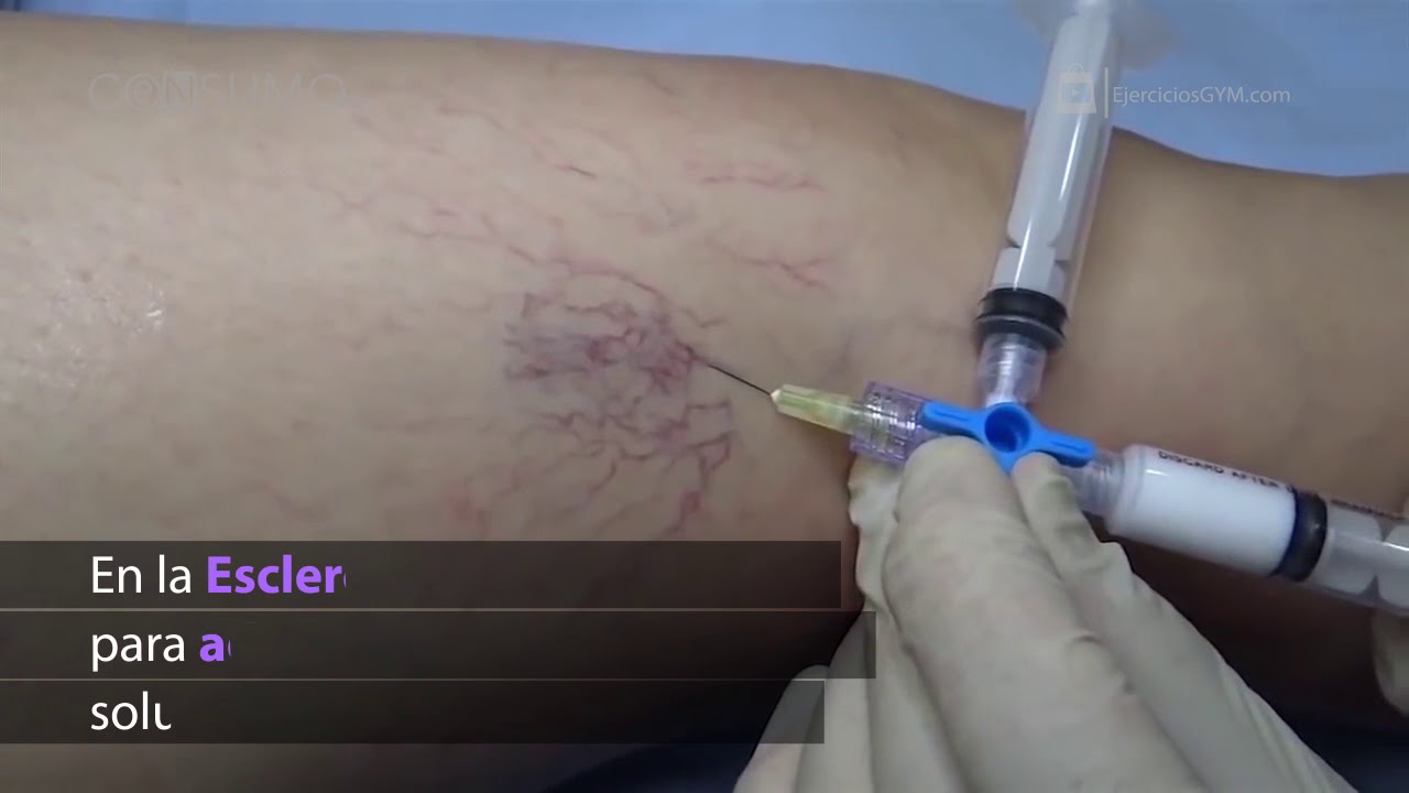 Gisela Molina Avilés-1