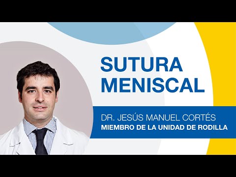 ¿Qué es una sutura meniscal?