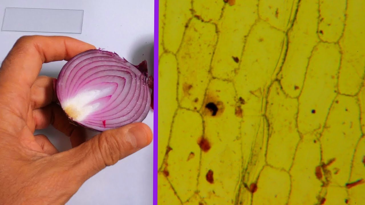 Onion Cells Under the Microscope