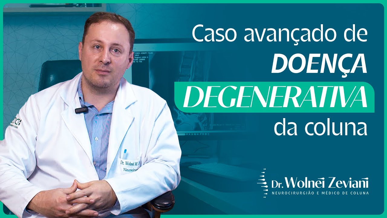 Caso avançado de doença degenerativa da coluna - Wolnei Zeviani explica
