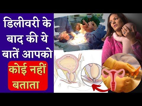 डिलीवरी के बाद की ये बातें आपको कोई नहीं बताता 😅🥹 Postpartum Care Tips in Hindi