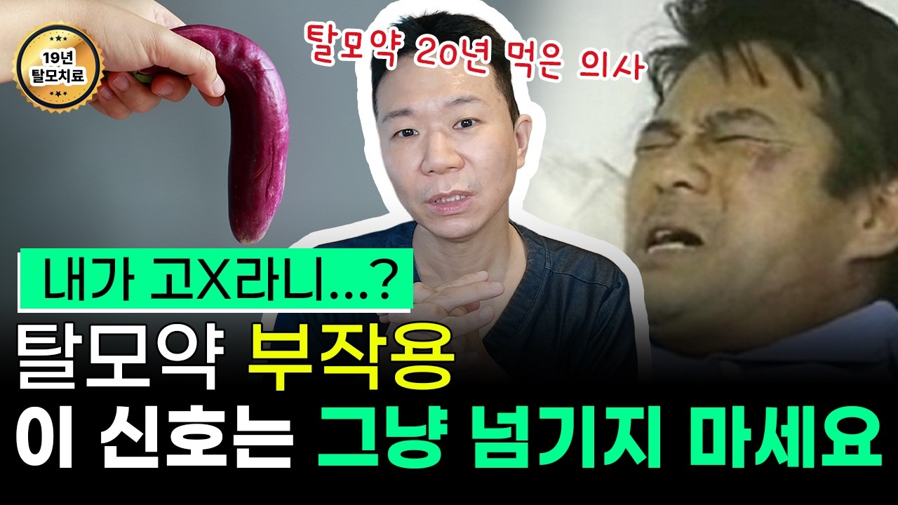 탈모약 질문1위 당장 중단해야하는 신호? 성기능·우울증 부작용 총정리