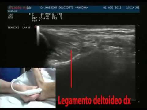 Sintomi displasia dellanca negli adulti Aiutare con infortunio alla caviglia