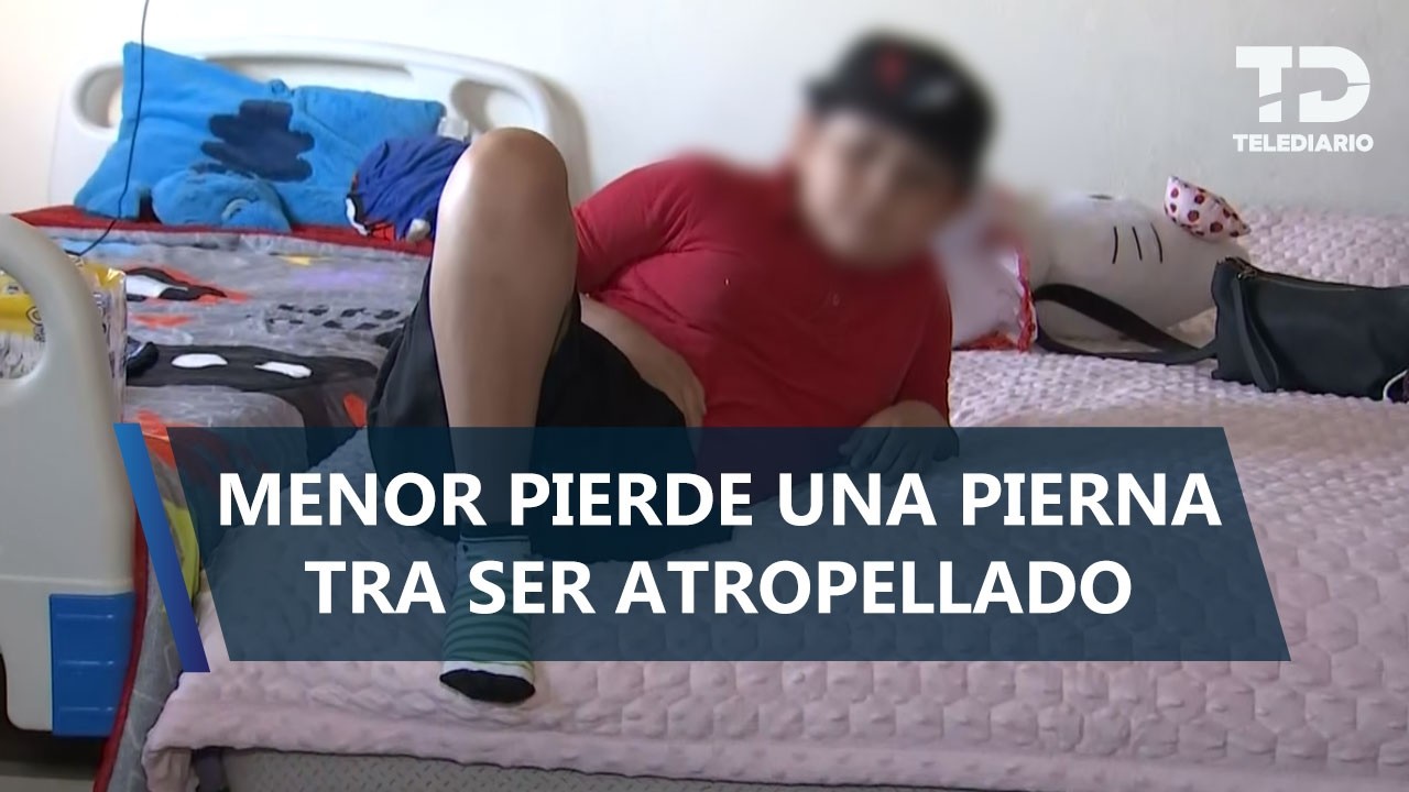 Emiliano, de 8 años, sufre amputación de pierna tras ser atropellado por una joven en CdMx