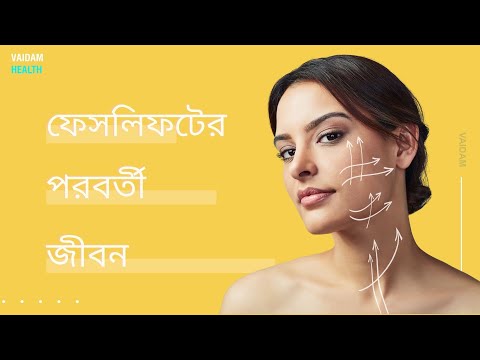 ফেসলিফটের পরবর্তী জীবন