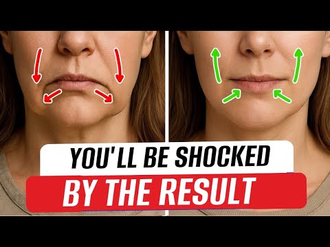 Lift Mouth Corners EASILY and Without Surgery! This Secret Method REALLY Works!