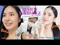 รีวิว ทำThermage ครั้งแรกในชีวิต ที่ Rukx Rayong C