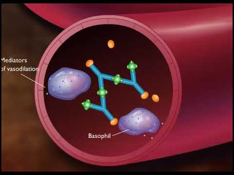 immune complex type iii hypersensitivity