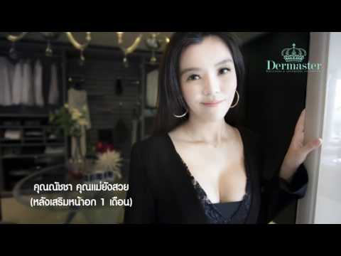 หลังการผ่าตัดเต้านมซิลิโคน หน้าอกเล็กเป็นประโยชน์