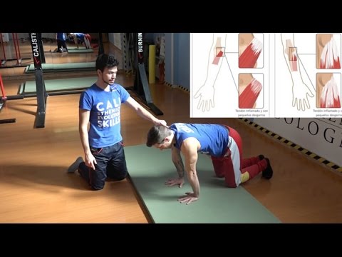 Osteocondrosi del nuoto toracica Come rimuovere il dolore della colonna cervicale ernia