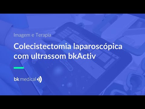 Colecistectomia laparoscópica com ultrassom bkActiv