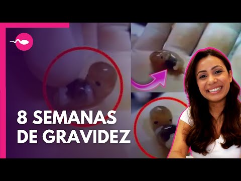 8 WEEKS PREGNANT | 2 MONTHS PREGNANT | PREGNANCY SYMPTOMS - Patrícia Moreira | Good Pregnancy