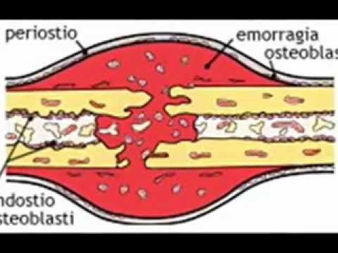 Parassita di betulla 4 lettere Lanalisi di un lyambliya costata