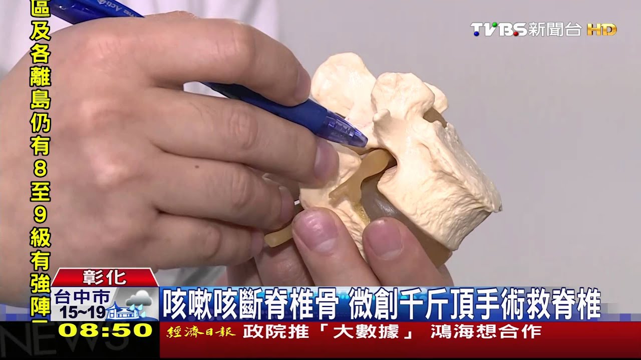 骨質疏鬆＋咳太大力　8旬老婦咳斷脊椎骨