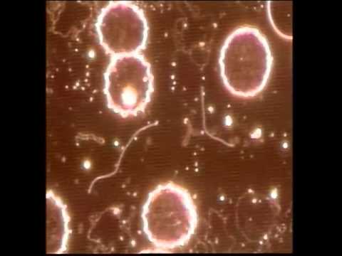 Prostata-Erkrankungen Code ICD Massage und Übungen für die Prostata
