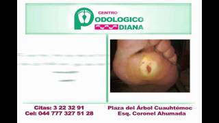 preview picture of video 'Centro Podológico Diana'