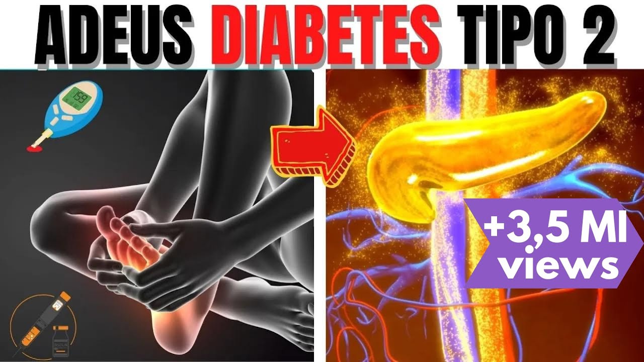 5 DICAS DE COMO REVERTER o PRÉ-DIABETES e o DIABETES TIPO 2 NATURALMENTE
