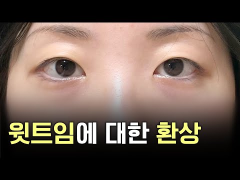 开眼角 03