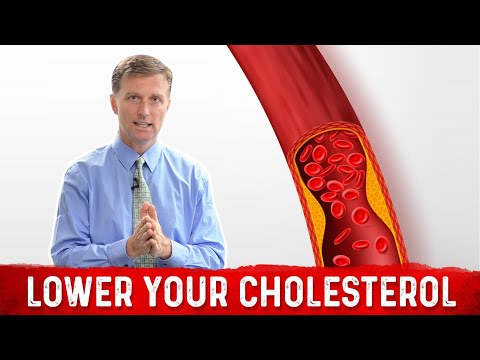 The Real Purpose of Cholesterol – Dr Berg on Cholesterol levels Part 1
