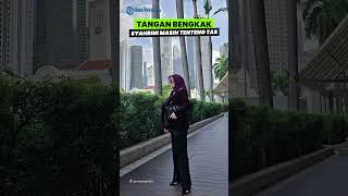 Tangan Bengkak Berbalut Perban hingga Jalani Perawatan Medis, Syahrini Masih Tenteng Tas Mewahnya