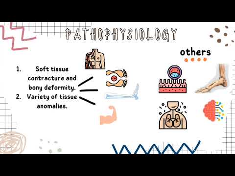 CONGENITAL TALIPES EQUINO-VARUS/VALGUS (CTEV)