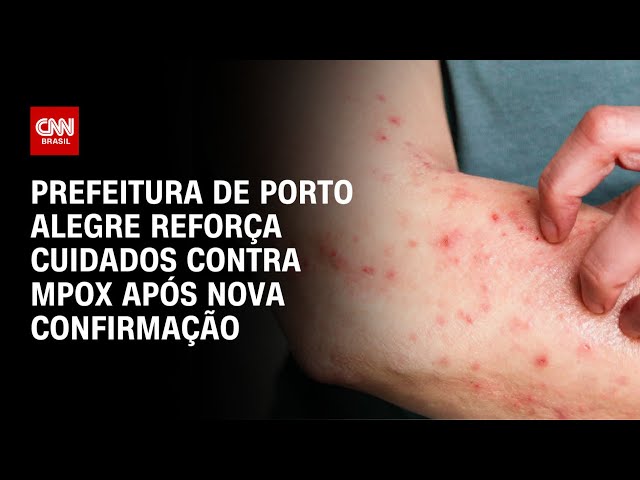 Primeiro caso de Mpox é confirmado em Porto Alegre em 2026 | CNN NOVO DIA