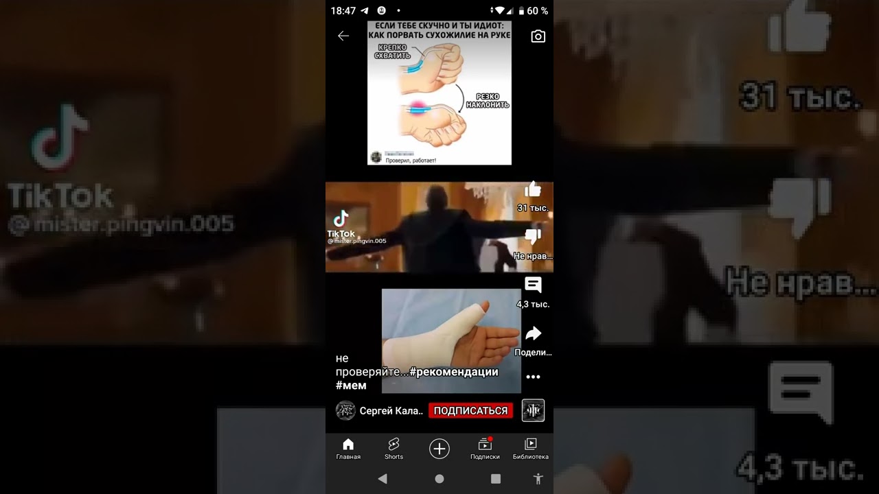 как порвать сухожилия на руке