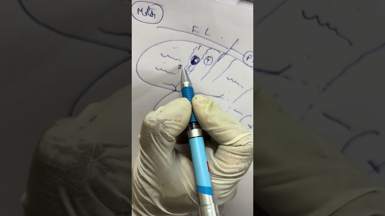 Functional areas of brain 