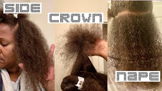 My strategy for camouflaging MULTIPLE TEXTURES & LENGHTS |Natural hair