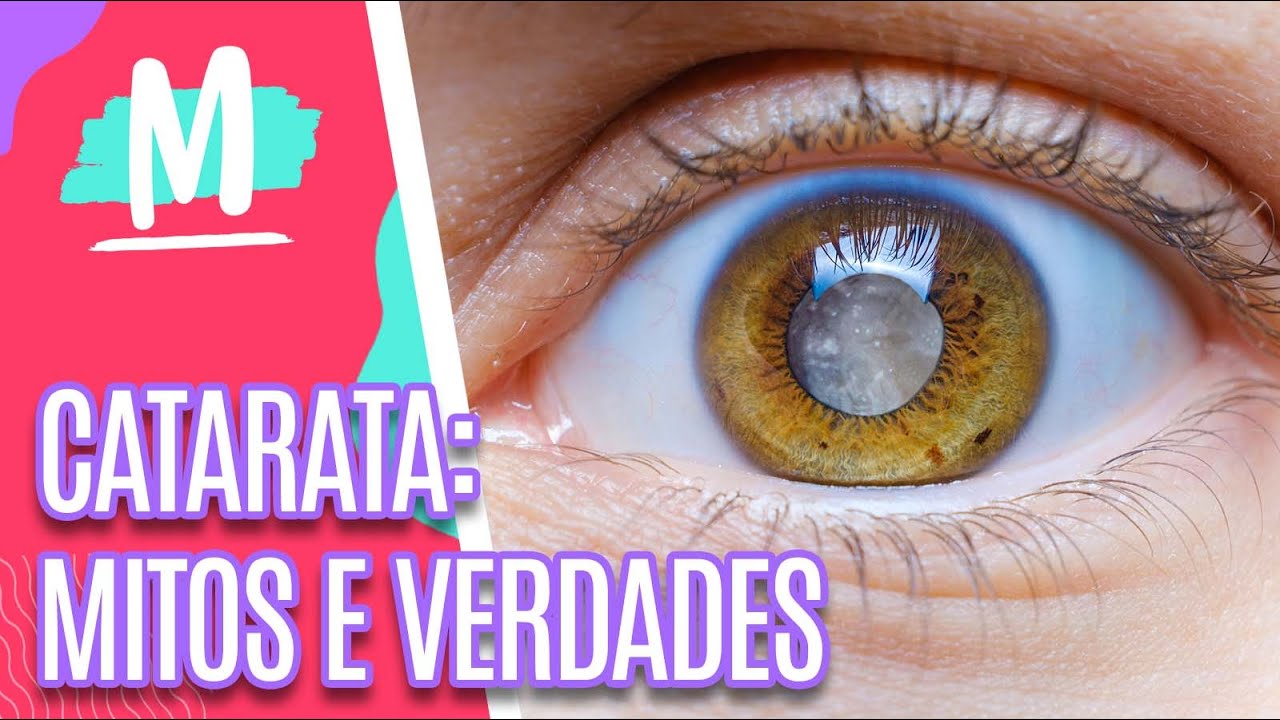 Conheça as causas, sintomas e a cirurgia para catarata - Mulheres (22/06/22)
