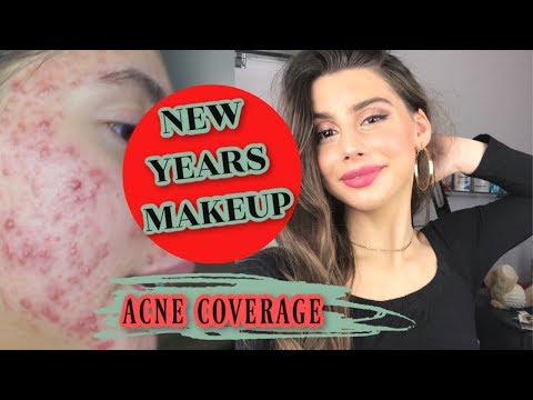 MY GLAM NEW YEARS ACNE COVERAGE MAKEUP ROUTINE!! || Cover FX, Wet N Wild, Marc Jacobs, Tarte