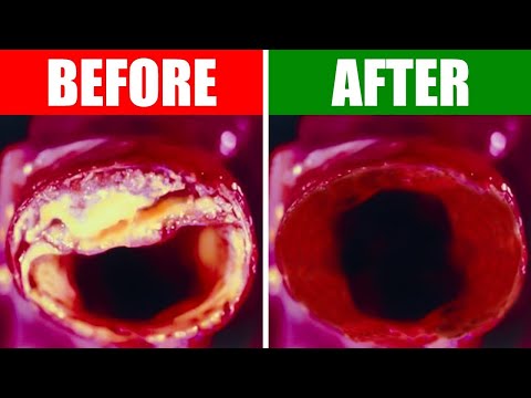 Weird Symptoms Explained by Dr Berg