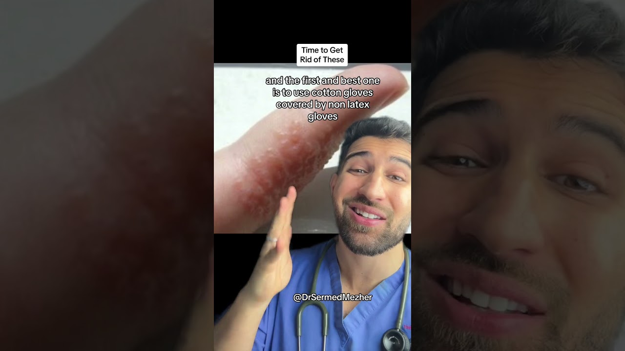 This is What Causes Those Annoying Bumps on Your Fingers #dry